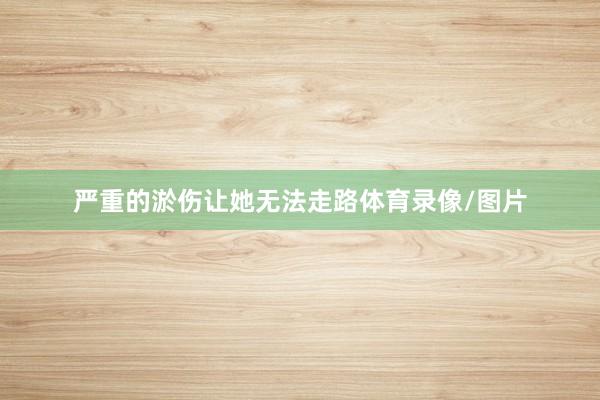 严重的淤伤让她无法走路体育录像/图片
